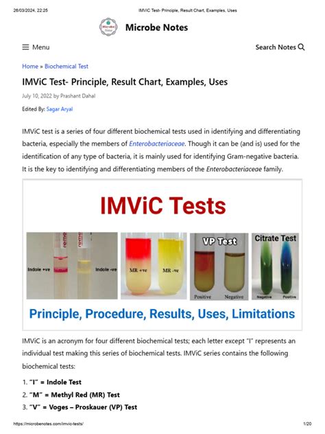 IMViC Test: Principle, Result Chart, Examples, Uses .